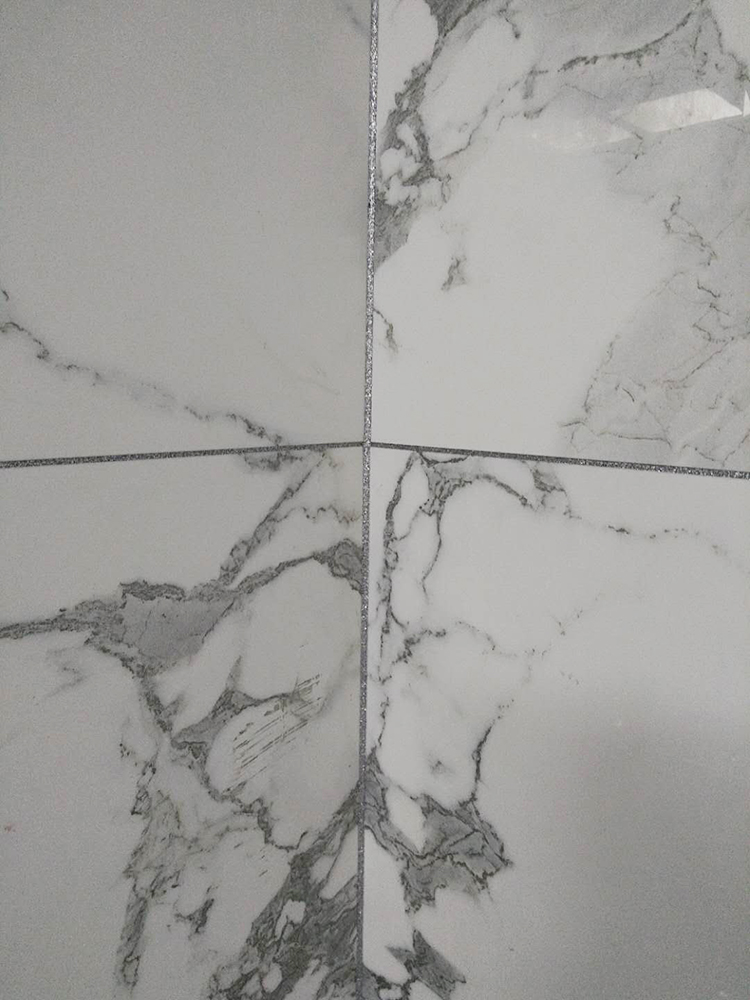 美缝效果